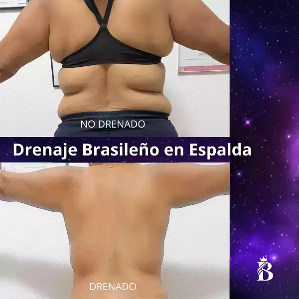NO-DRENADO-_1_ (1)-min